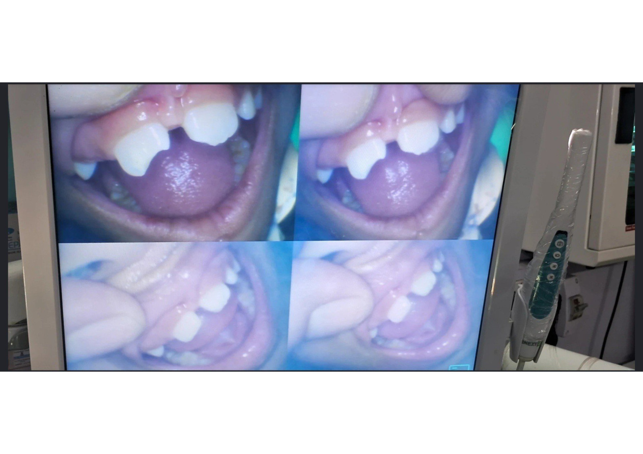 Dental imaging