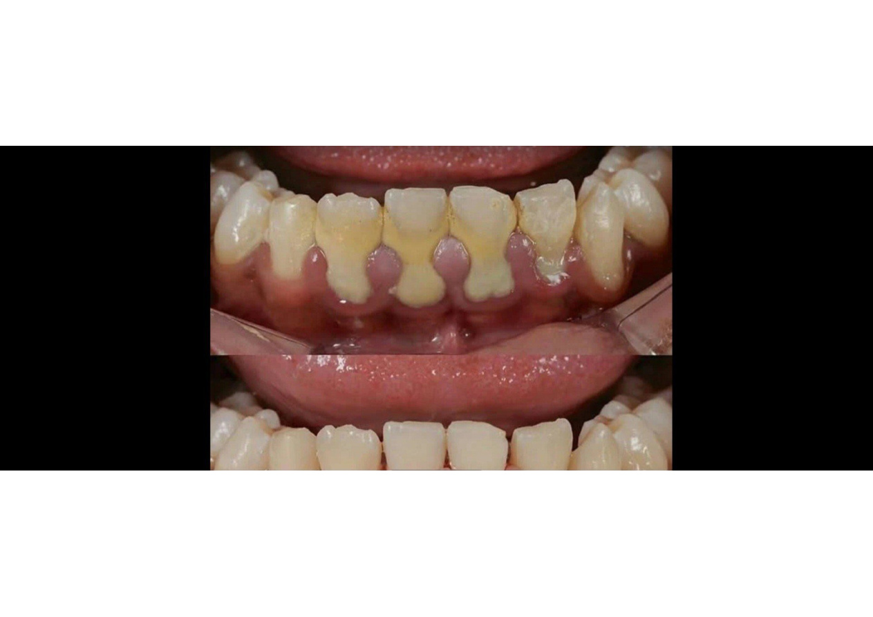 Dental treatment image