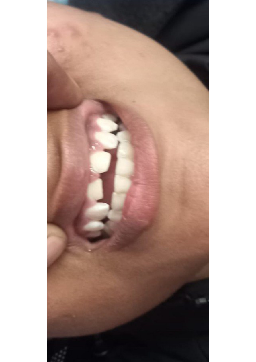 Dental clinical photograph