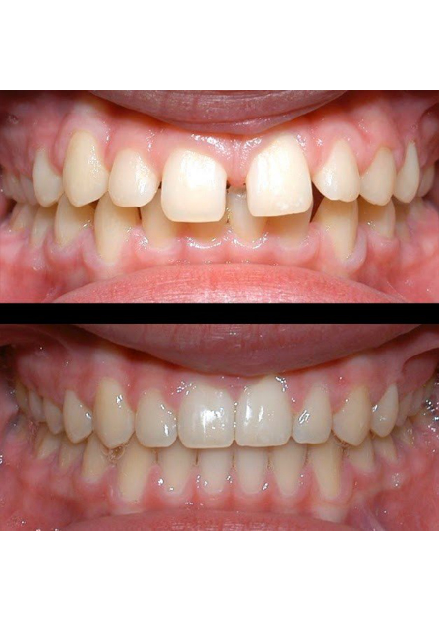Dental treatment result